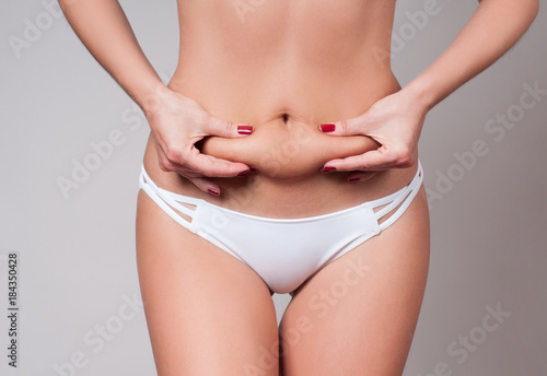 Fat female belly, woman holding her skin for cellulite check.