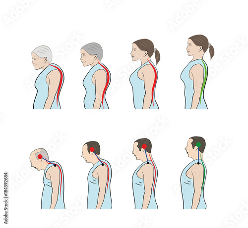 Development of a stooped stance with age, showing increasing curvature of the spine in men and women. vector illustration
