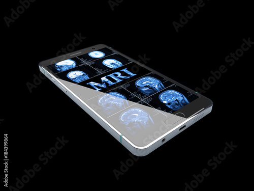 3D Illustration of Medicine concept: Smartphone with blue text MRI and X-ray of the skull on display, isolated black photo