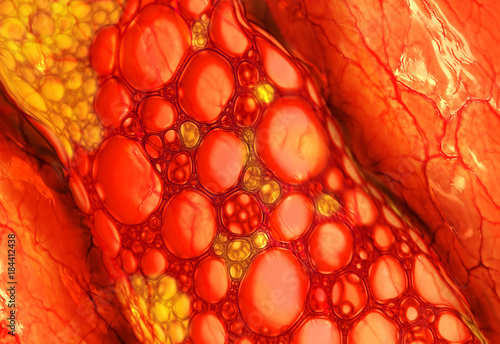 Konstfotografi Cholesterol plaque in blood vessel
