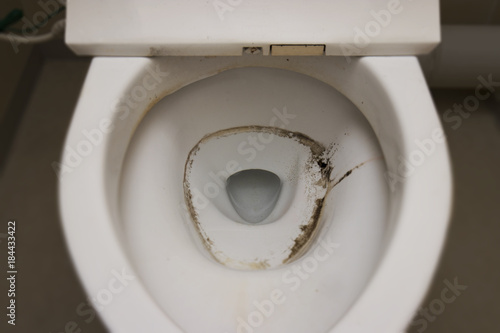 Foto 汚れたトイレの便器