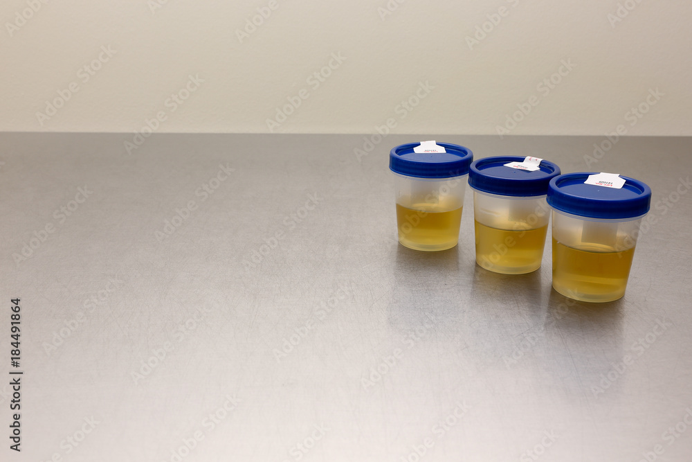 Drug Test Urinalysis Stock Photo Adobe Stock