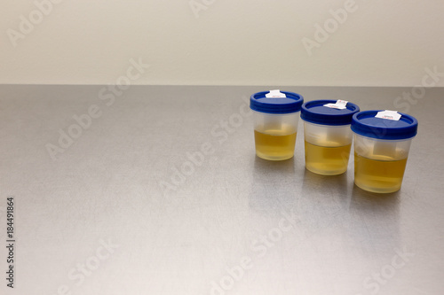 Drug Test Urinalysis