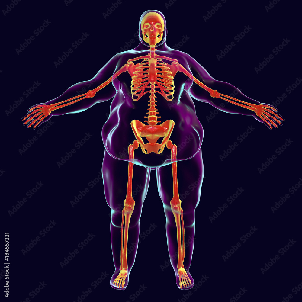 Obesity Problem Conceptual Image 3D Illustration Showing Normal obesity-problem-conceptual-image-3d-illustration-showing-normal
