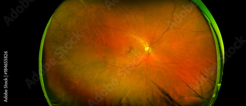 eye's retinal angle image with macula, vessels and optic disc isolated view on a black bacground. made by ultra wide fundus camera photo