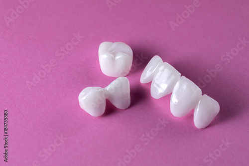 Zircon dentures on a pink background - Ceramic veneers - lumineers
