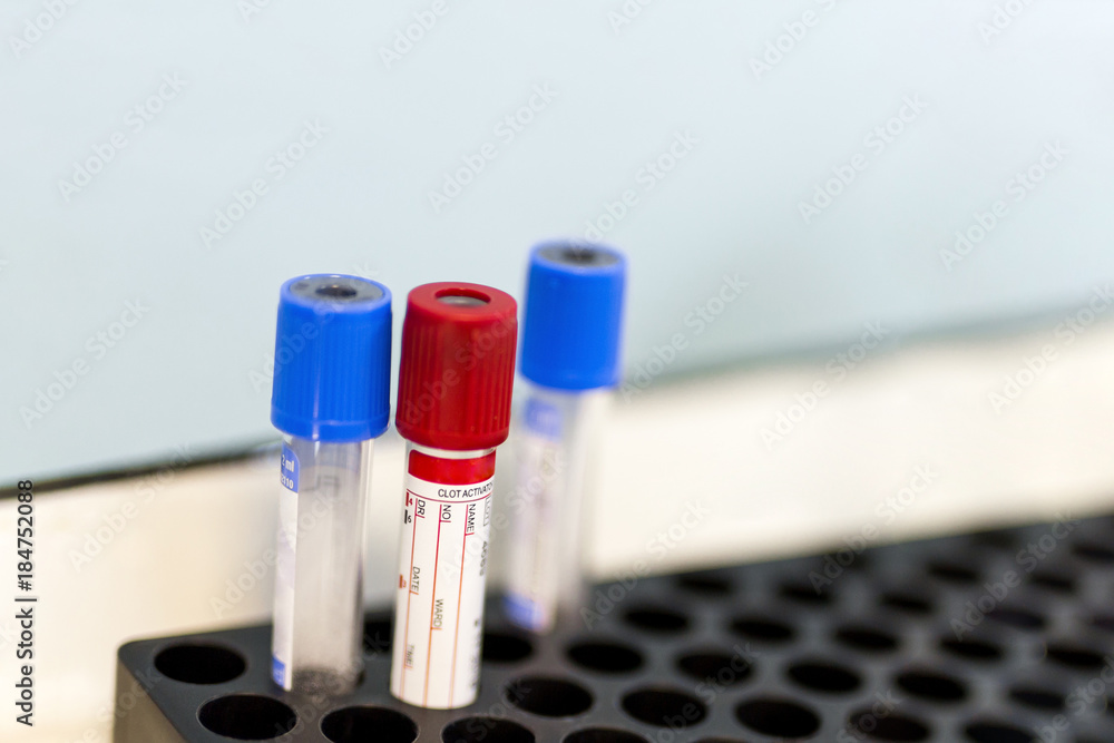 Lot of empty labaratory blood analysis tubes at medical center Lot of empty labaratory blood analysis tubes at medical center