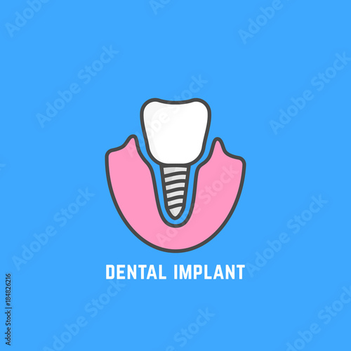 simple icon of white dental implant