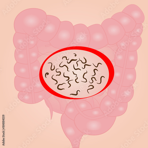 helminths in a small intestine