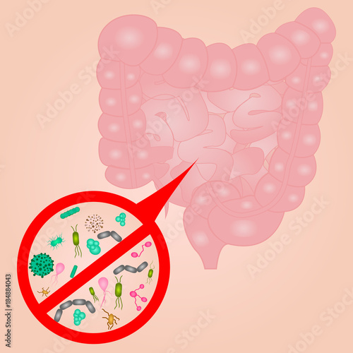 Stop Bacterial overgrowth in small  intestine sign photo