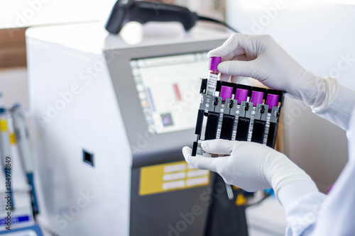 Scientists tested with automated hematology analysis in laboratory