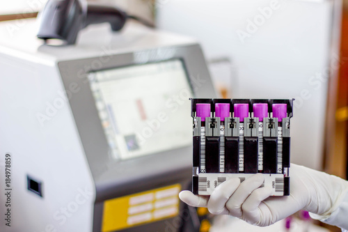 The blood in EDTA tube for test complete Blood Count (cbc) testing hematology laboratory.