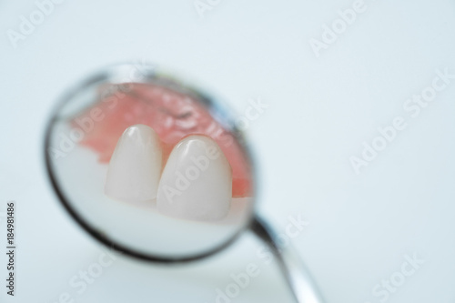 Dental prosthetic isolatic - partial denture upper side.