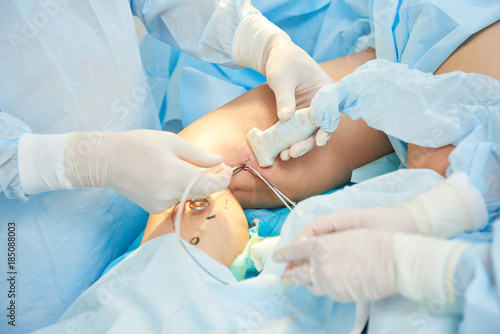 Surgery of varix vein