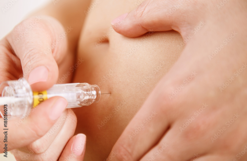 Abdominal injection Abdominal injection
