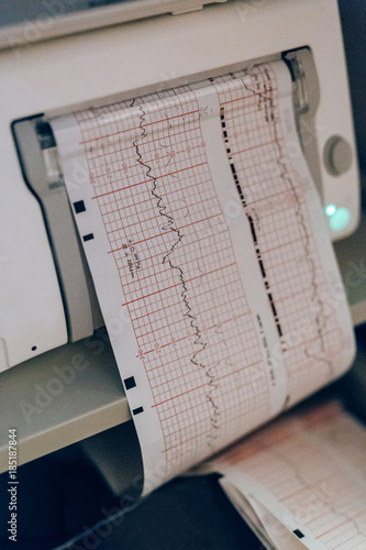 Fetal heart rate and contraction monitor