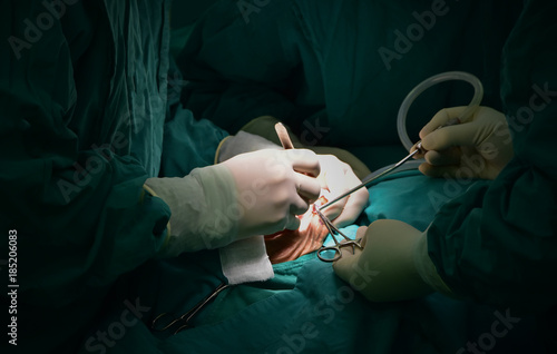 Surgical images by doctors and nurses in the operating room. Concepts for emergency and medical treatment or as an illustration of the beauty of surgery.