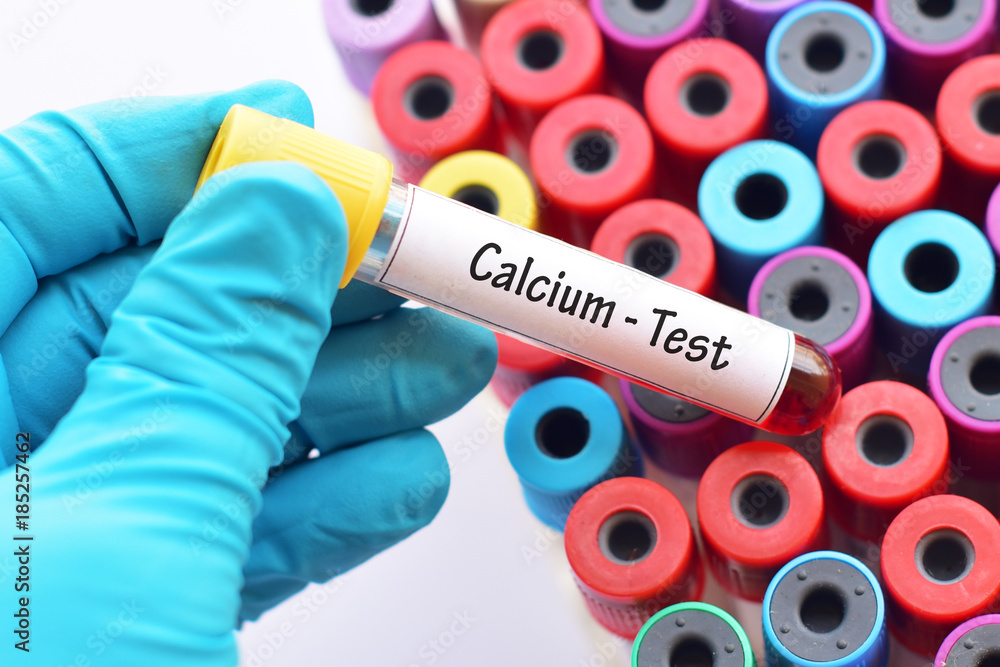 Fototapeta premium Test tube with blood sample for calcium test