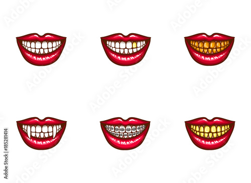 Set of vector red female lips with white healthy teeth and perfect smile  with vampire fangs  with metal dental crowns and implants  with braces. Pop art style illustration. Clipart for dental design