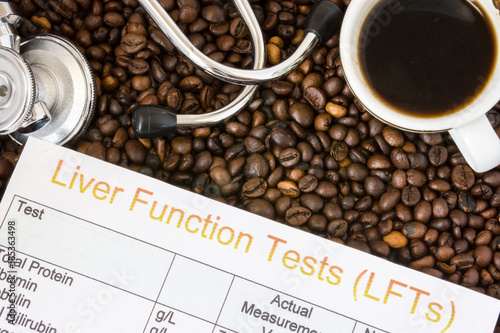 Influence of coffee or caffeine on liver functions, enzymes, activity. Result of liver function test examination near mug with coffee, stethoscope and glasses in  background roasted coffee beans