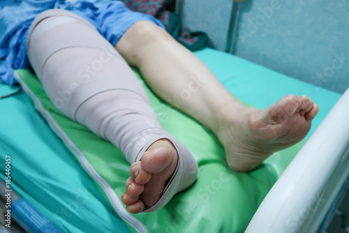 Leg with bandage after surgical operation knee