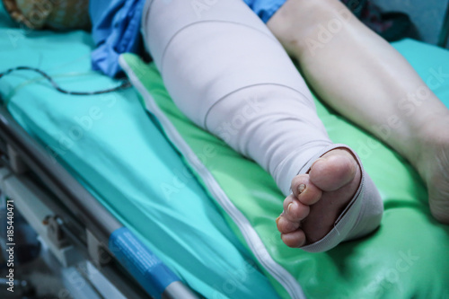 Leg with bandage after surgical operation