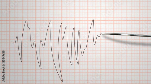 Photos Diagram of a Detertor of Lie