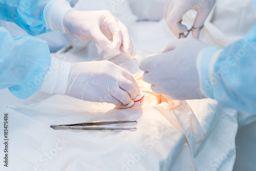 the hands of surgeons physicians doing surgery to the patient in the clinic, the concept of photo medicine, professional doctors, anesthesia