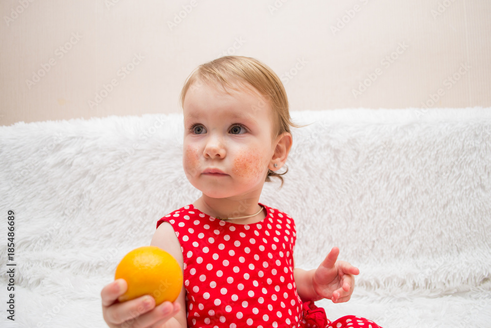 cute little girl a child with eczema or an allergy on her cheeks
