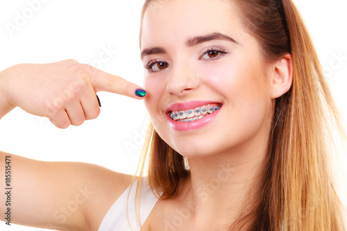 Woman smiling showing teeth with braces