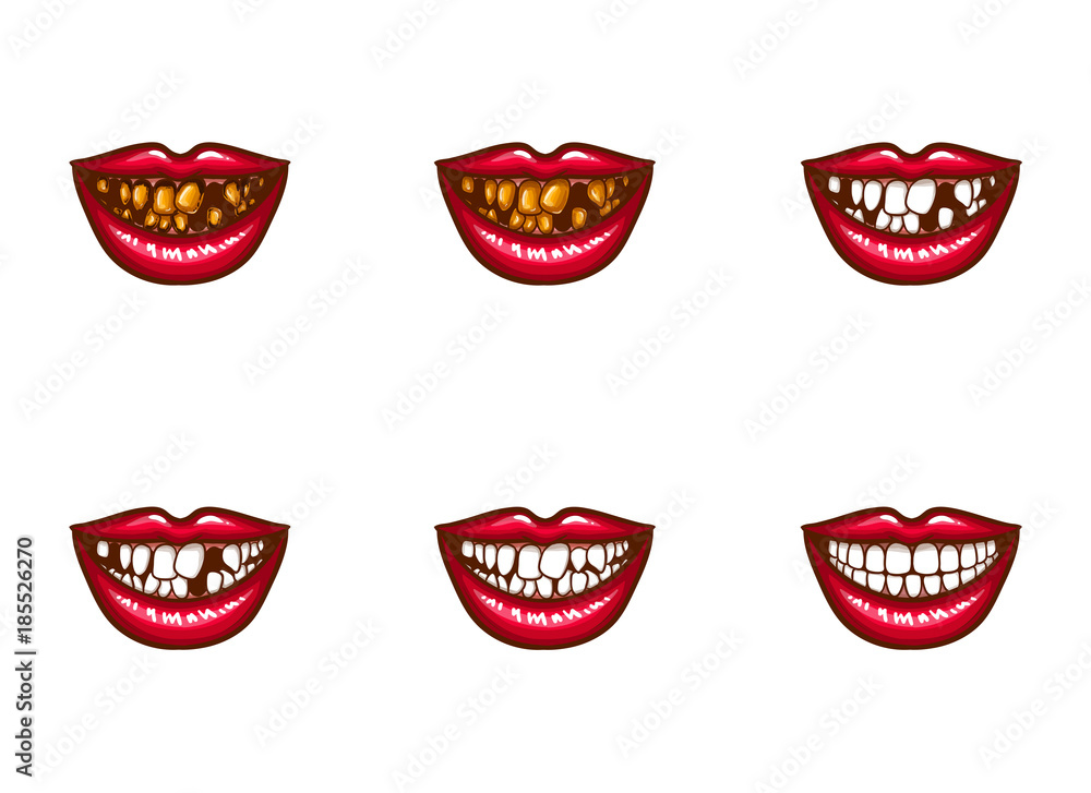 toothy grin clip art