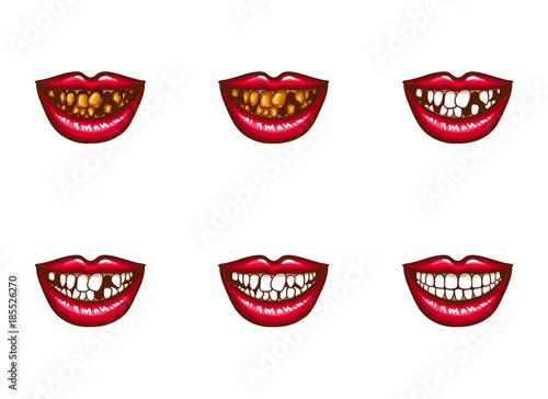 Clipart of vector female mouths with dental problems. Spoiled, darkened, nasty, crooked teeth, tooth loss, gums disease and white perfect healthy smile. Pop art style illustration. Isolated elements