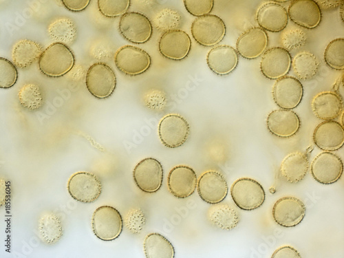 Spores of a slime mold, or myxomycete. Yellow color. High score microscopy. Slime moulds are special organisms that gather from many microscopic unicellular amoebae photo