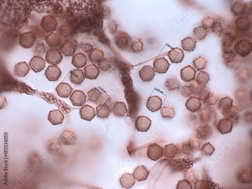 Fotografie Spores of a slime mold, or myxomycete