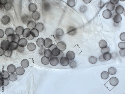 Tablou pe pânză Spores of a slime mold, or myxomycete