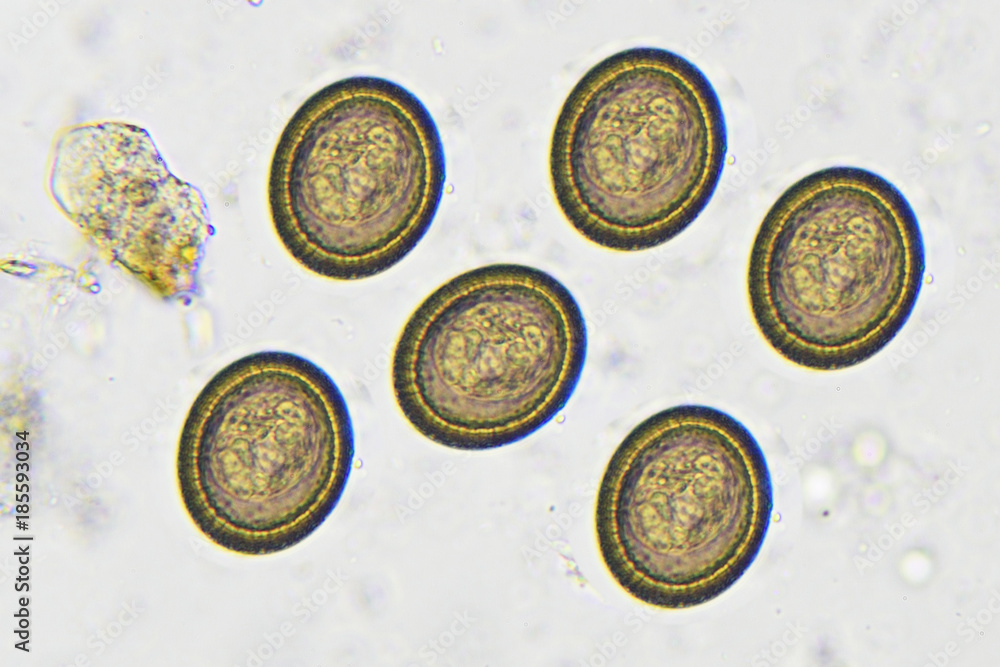 Eggs Of Taenia In Stool Analyze By Microscope Stock Photo Adobe Stock eggs-of-taenia-in-stool-analyze-by-microscope-stock-photo-adobe-stock