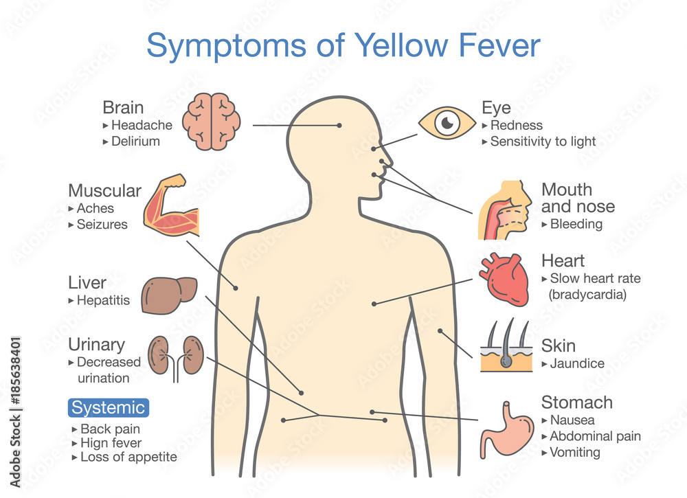 Как выглядит мононуклеоз у детей