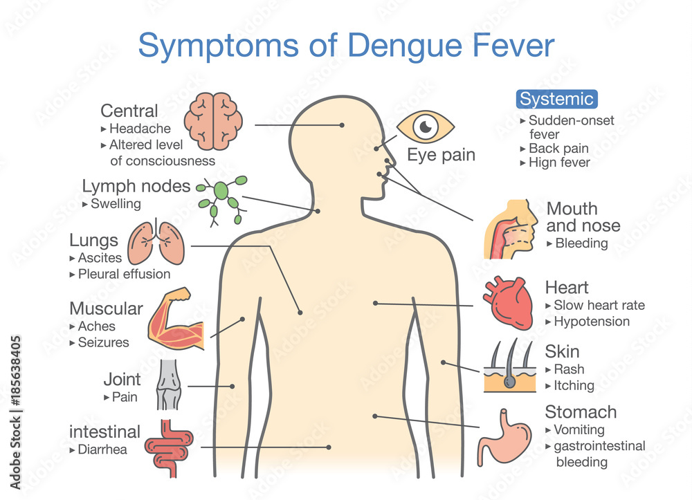 Dengue Symptoms dengue-symptoms