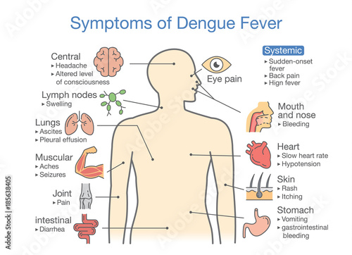 Symptoms of Dengue Fever patient. Illustration about diagram for health check up.