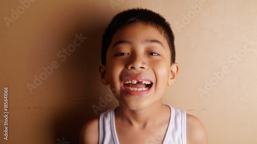 Foto Tooth remove in dental surgery, growing new tooth on gum