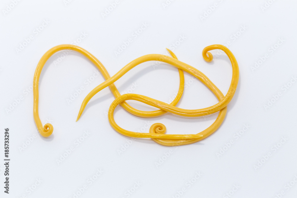 Ascariasis is a disease caused by the parasitic roundworm Ascaris lumbricoides on white background for education in laboratories. Ascariasis is a disease caused by the parasitic roundworm Ascaris lumbricoides on white background for education in laboratories.