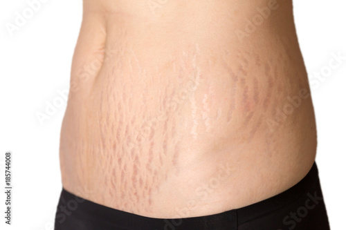 Woman belly fat pattern