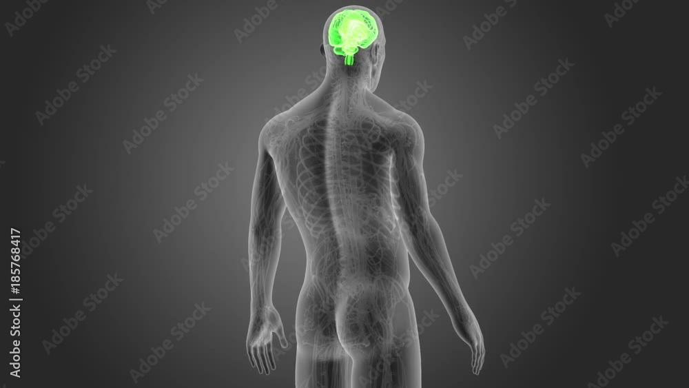Brain with CS Brain with CS