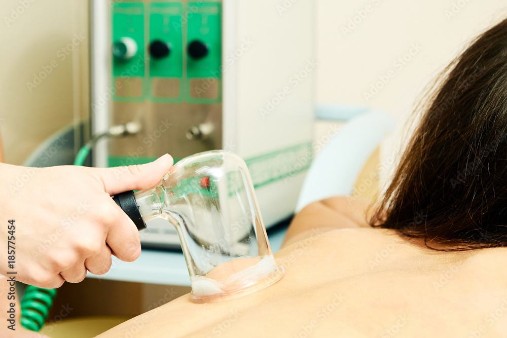 Medical procedure. Vacuum massage. Girl patient Medical procedure. Vacuum massage. Girl patient