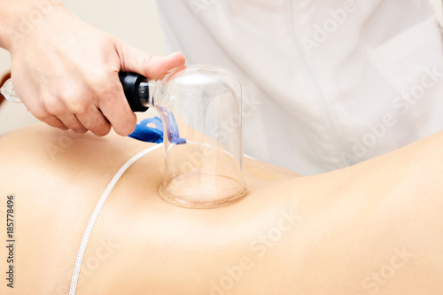 Slimming procedure. Modern medicine. Vacuum massage. Girl patient