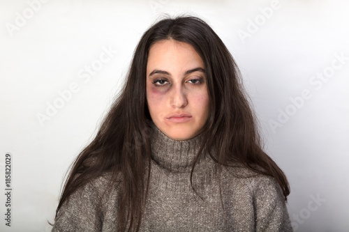Abused woman the victim of domestic violence