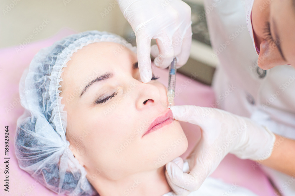 .Lip augmentation, cosmetology, beauty, plastic surgery .Lip augmentation, cosmetology, beauty, plastic surgery