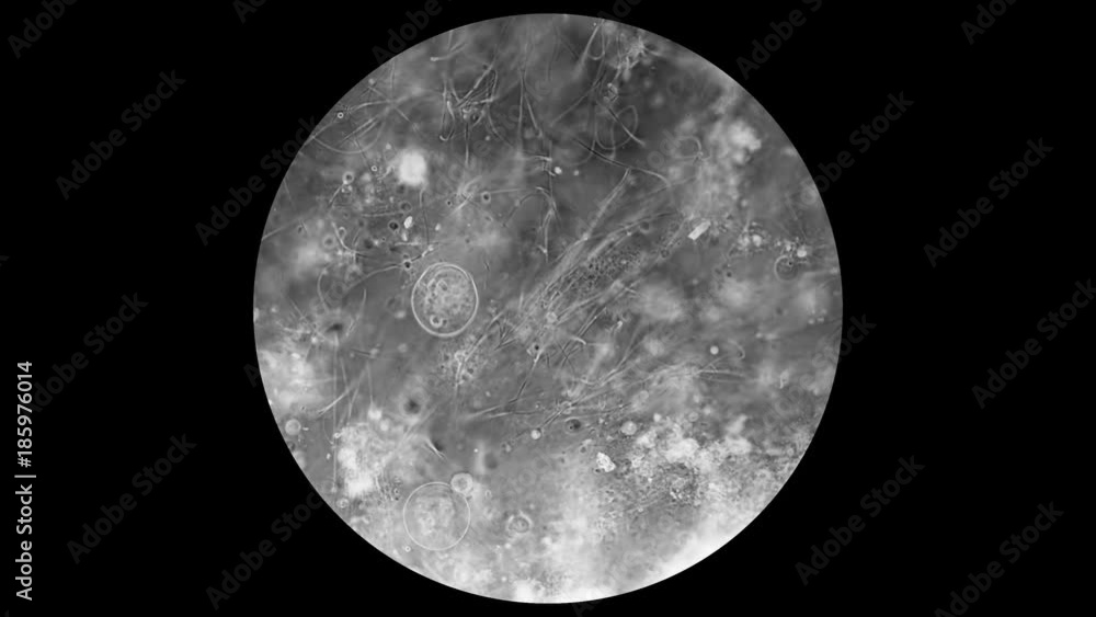 transparent microorganism under the microscope, with internal organs, as is an alien organism transparent microorganism under the microscope, with internal organs, as is an alien organism