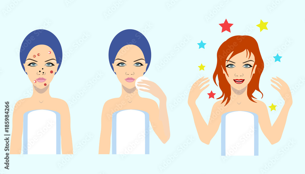 acne treatment before after, vector illustration acne treatment before after, vector illustration