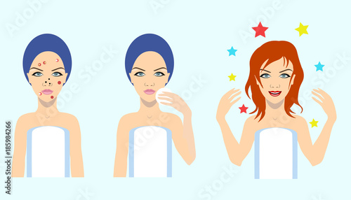 acne treatment before after, vector illustration